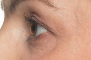 Ergebnis nach 4 Wochen