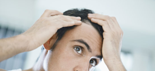 Das Bild zeigt einen Mann, der sich besorgt über seinen Haaransatz beugt und mit beiden Händen seine Kopfhaut untersucht. Er betrachtet aufmerksam seine Haarlinie, was darauf hinweist, dass er möglicherweise über Haarausfall nachdenkt. Die Szene ist in einem gut beleuchteten Raum, was auf eine Umgebung wie ein Badezimmer oder eine Klinik hinweisen könnte. Dieses Bild wird in Verbindung mit dem Thema Haartransplantation in Wien verwendet. Bei Dermacare Wien kann so eine Behandlung gebucht werden.