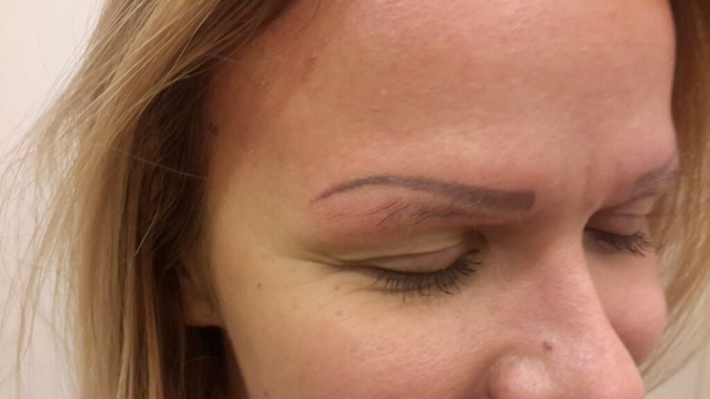 Permanent Make-up-Entfernung bei Dermacare