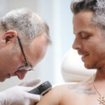 Muttermalkontrolle bzw. Hautkrebsvorsorge bei Dermacare