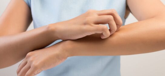 Behandlung von Neurodermitis – Dermatologische Leistungen bei Dermacare