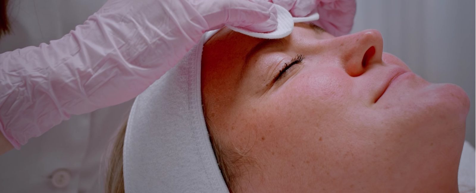 PQAge Peeling: Kosmetik Behandlungen bei Dermacare in Wien