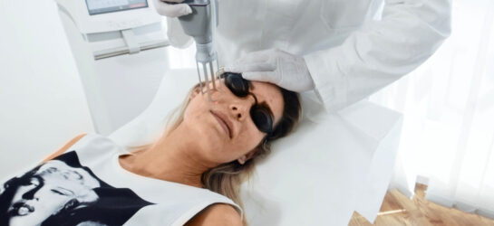 Auf dem Bild ist eine ästhetisch-medizinische Behandlung in einer professionellen Praxis zu sehen. Eine Patientin liegt entspannt auf einer Behandlungsliege, während ein medizinischer Spezialist mit Handschuhen ein modernes Lasersystem im Gesicht der Patientin anwendet. Die Patientin trägt eine Schutzbrille, um ihre Augen während der Lasertherapie zu schützen. Bei der Behandlung handelt es sich um eine schonende und präzise Laseranwendung, wie sie auch bei Dermacare Wien eingesetzt wird, um Pigmentflecken entfernen zu lassen und den Teint zu verfeinern. Der Hintergrund ist klinisch sauber und modern, was auf hohe medizinische Standards und professionelle Hautbehandlungen hinweist.