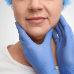 Das Bild zeigt eine Frau, deren Gesicht und Kinnpartie im Fokus stehen. Sie trägt eine blaue Haube, was auf eine klinische Umgebung hinweist, und es sind zwei Hände in blauen Handschuhen zu sehen, die sanft ihr Kinn umfassen. Diese Szene könnte den Beginn einer ästhetischen Behandlung zeigen, bei der das Doppelkinn durch eine minimal-invasive Methode wie Radiofrequenz Microneedling gegen Doppelkinn behandelt wird. Diese Technik hilft dabei, das Kinn zu straffen und das Doppelkinn ohne Operation zu reduzieren. Die Frau wirkt ruhig und vorbereitet auf die Behandlung.