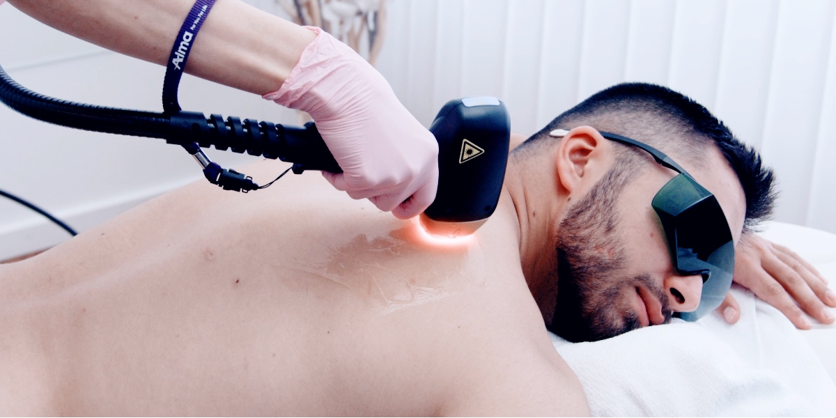 Auf diesem Bild sieht man einen Mann der eine Körperenthaarung bei Dermacare bekommt. Er liegt auf dem Bauch und der Laser gleitet geschmeidig über seinen Rücken.