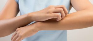 beahandlung neurodermits dermacare 1010 wien 1200x800 1