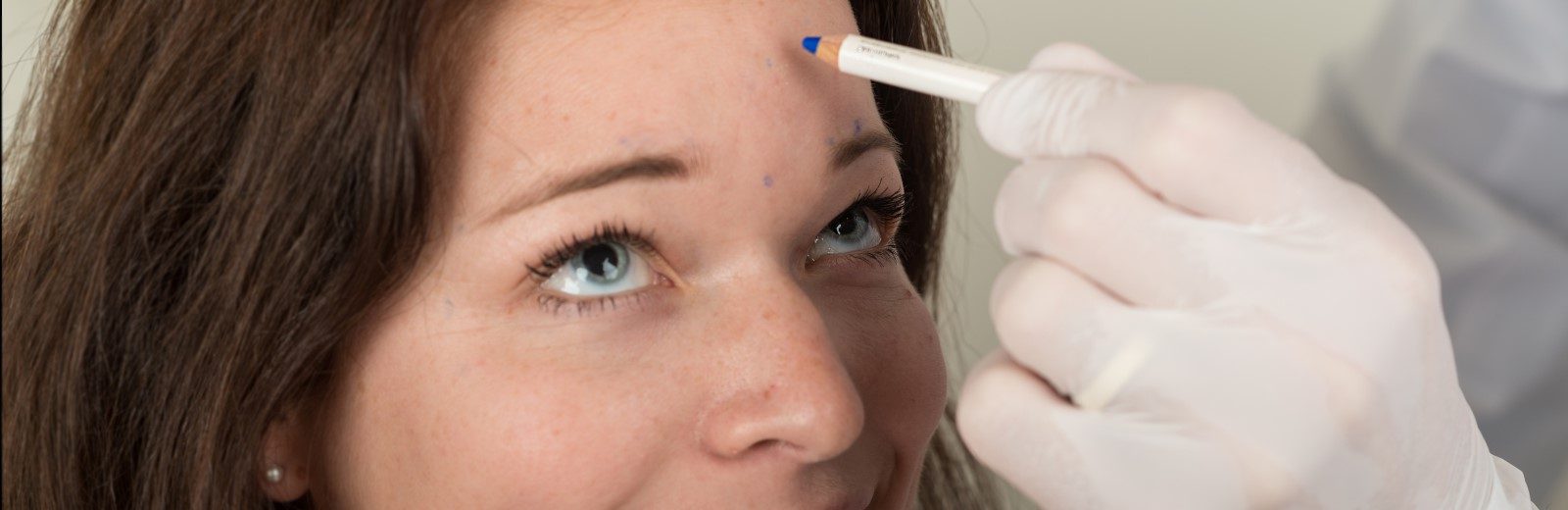 botox wien dermacare e1489091585395