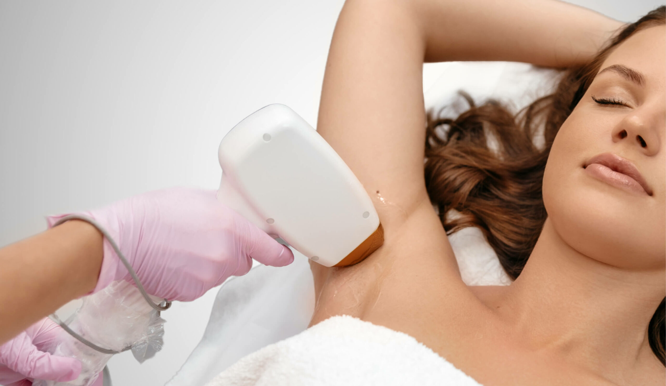 transgender Laserhaarentfernung wien Behandlungsbilder dermacare wien scaled