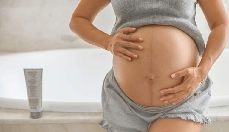 wie fangen schwangerschaftsstreifen an bauch schwangerschaftsstreifen e1753456551198