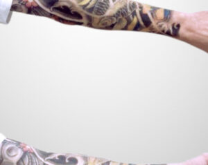 Tattooentfernung Vorher-Nachher Bilder Arm Cover Up nachher bild tattooentfernung dermacare wien 816x650 1