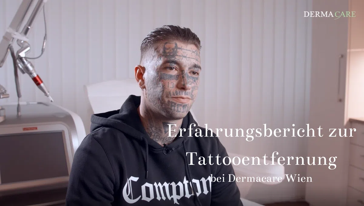 Erfahrungsbericht zur Tattooentfernung 6 mit