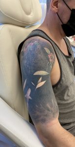 Tattooentfernung Vorher-Nachher Bilder Hier sieht man ein vollflächiges schwarzes Tattoo am Arm. Es ist ein Vorher Bild befor es weggelasert wird bei dermacare wien. Tattooentfernung vorher Bild