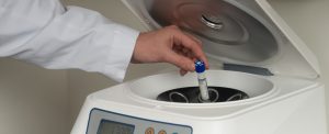 Zentrifugieren des Blutes PRP Vampirlifting 1600x650 1